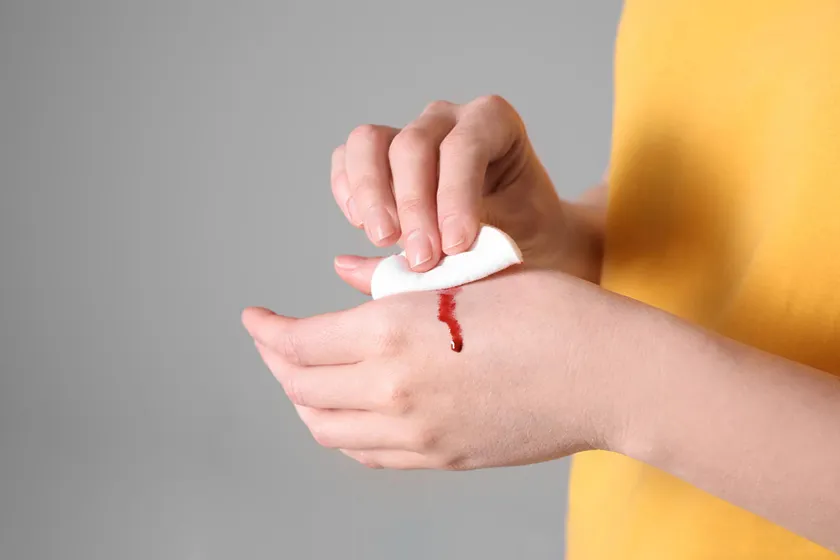 血液恐怖症とは?注射や怪我で血を見るのが怖い場合の克服法