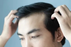 ストレスで抜け毛が増えて来た時の対処法：５分改善トレーニング
